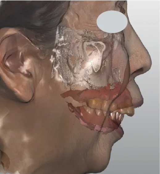 術前フェイススキャン