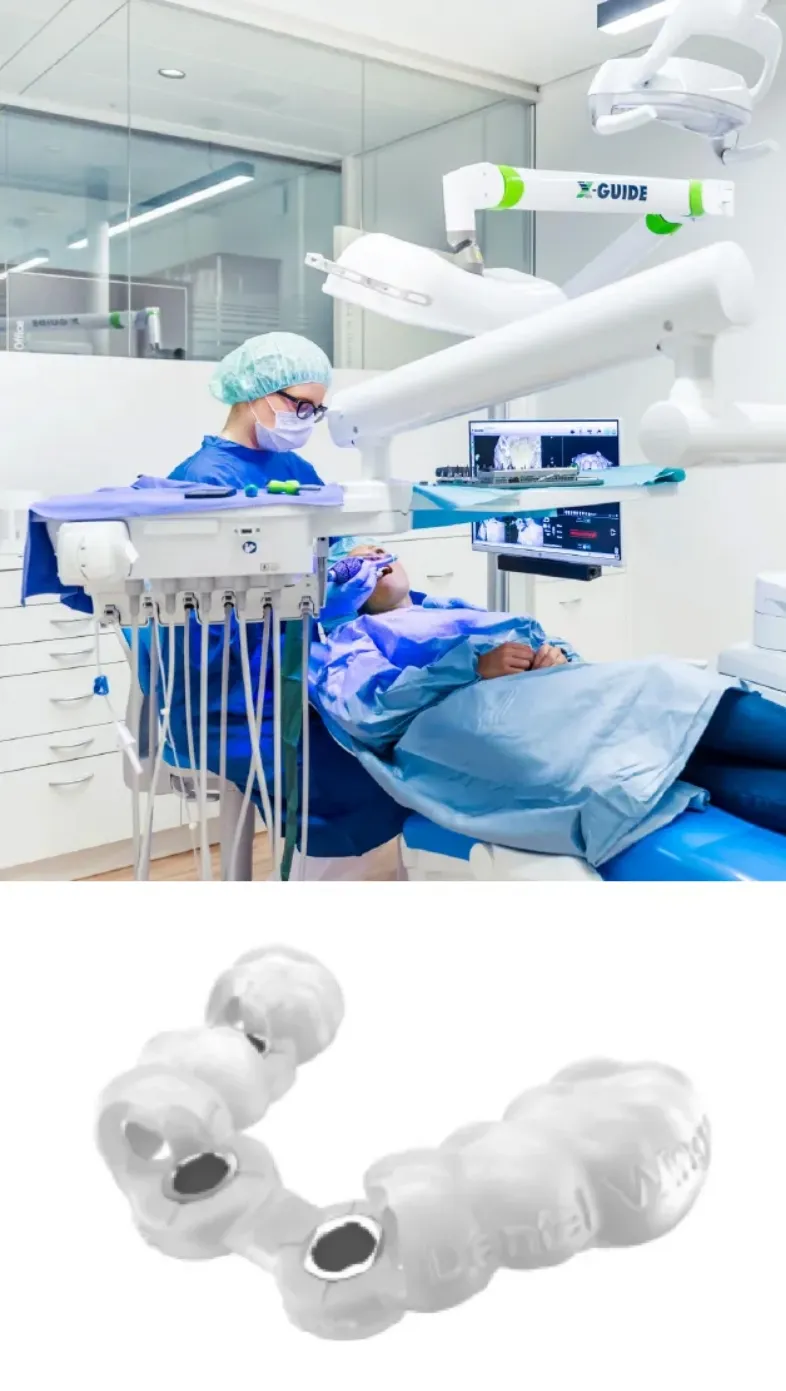 コンピューターガイド手術