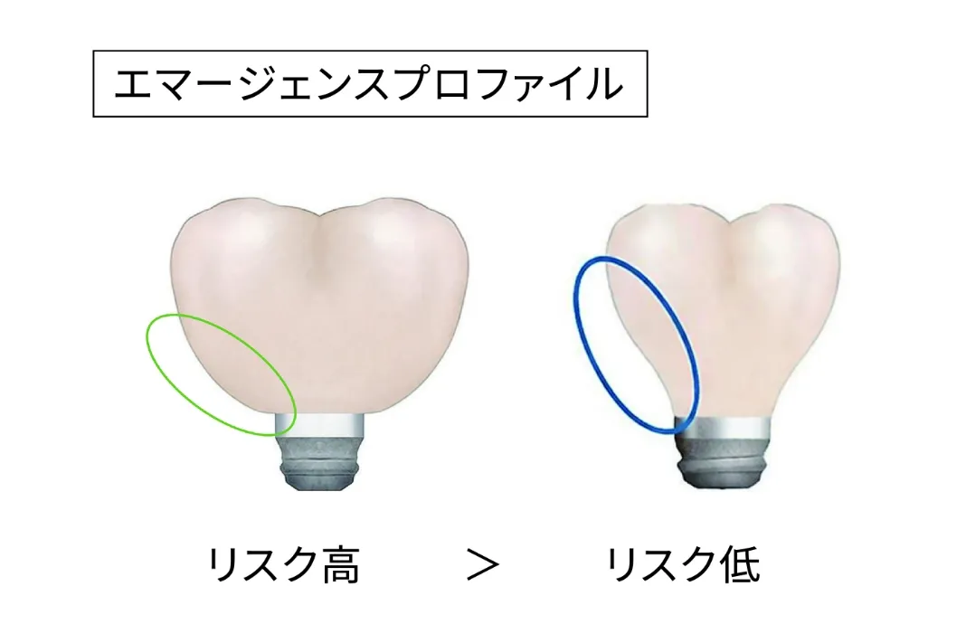 エマージェンスアングル リスク高低比較