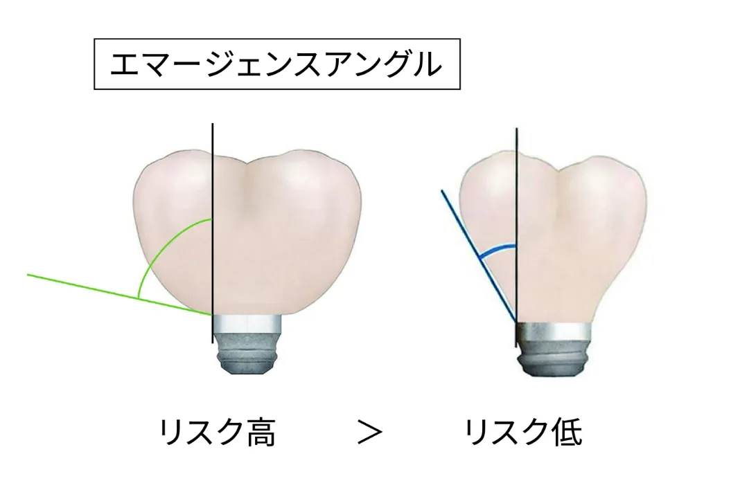 エマージェンスプロファイル リスク高低比較