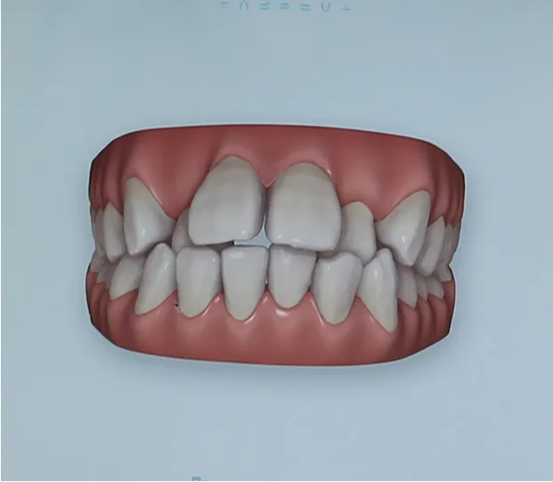 矯正用資料採取
