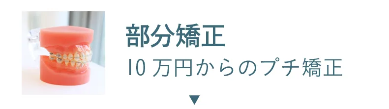部分矯正 10万円からのプチ矯正